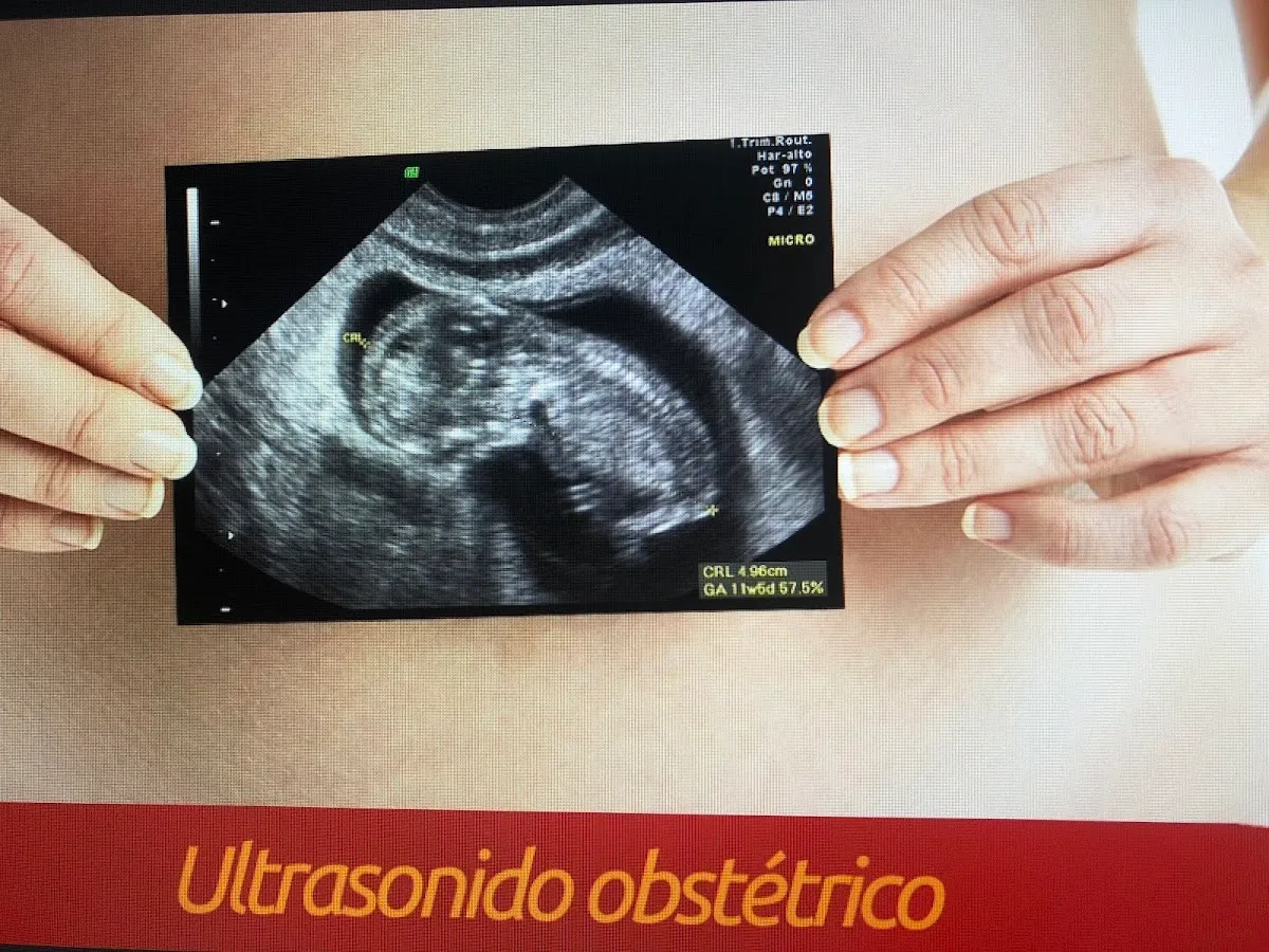 Foto 2 de Integral, por GINECOLOGÍA INTEGRAL , COLPOSCOPIA Y OBSTETRICIA