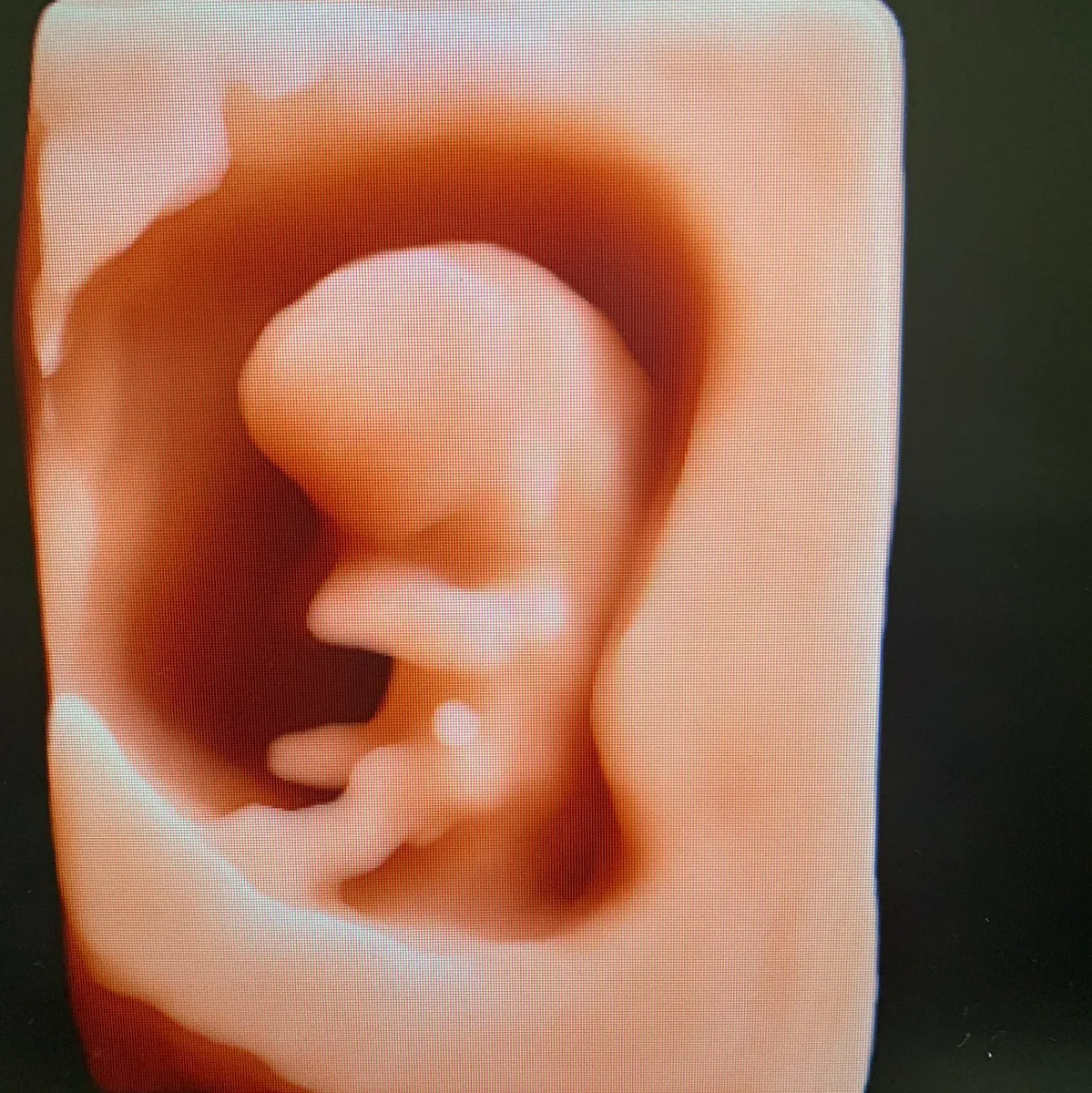 Foto 4 de Consultorio Médico de Ginecología y Obstetricia, por Consultorio Médico de Ginecología y Obstetricia