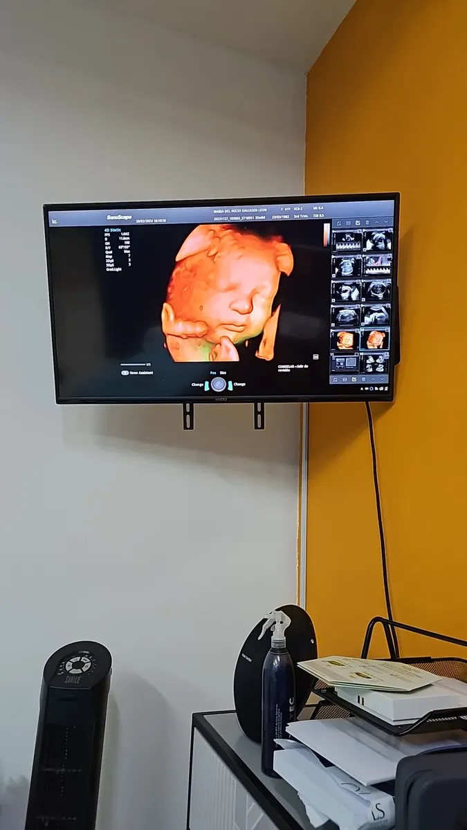 Foto 4 de Gine Rogelio jimenez toledo, por Consultorio de Ginecología