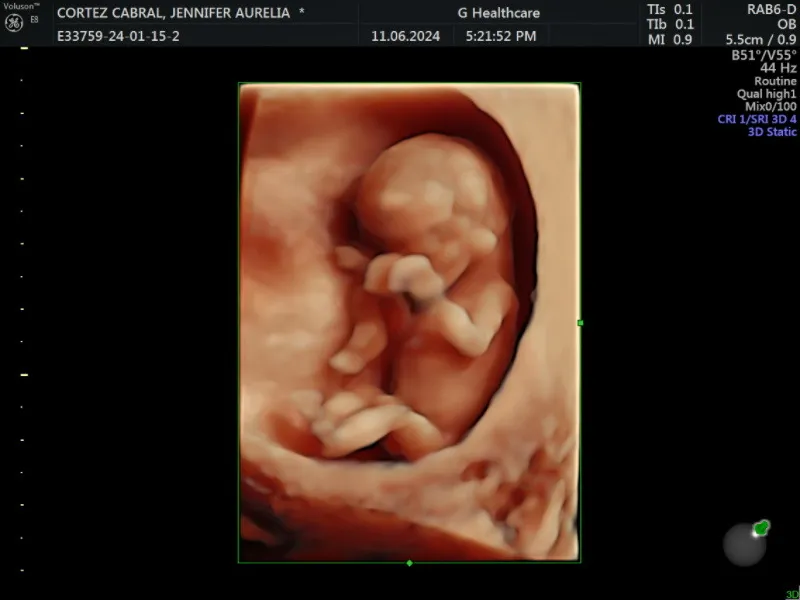 Foto 2 de Dra. Alma Ramírez Gine, por Dra Alma Ramírez Gine - Medicina Fetal - Monterrey