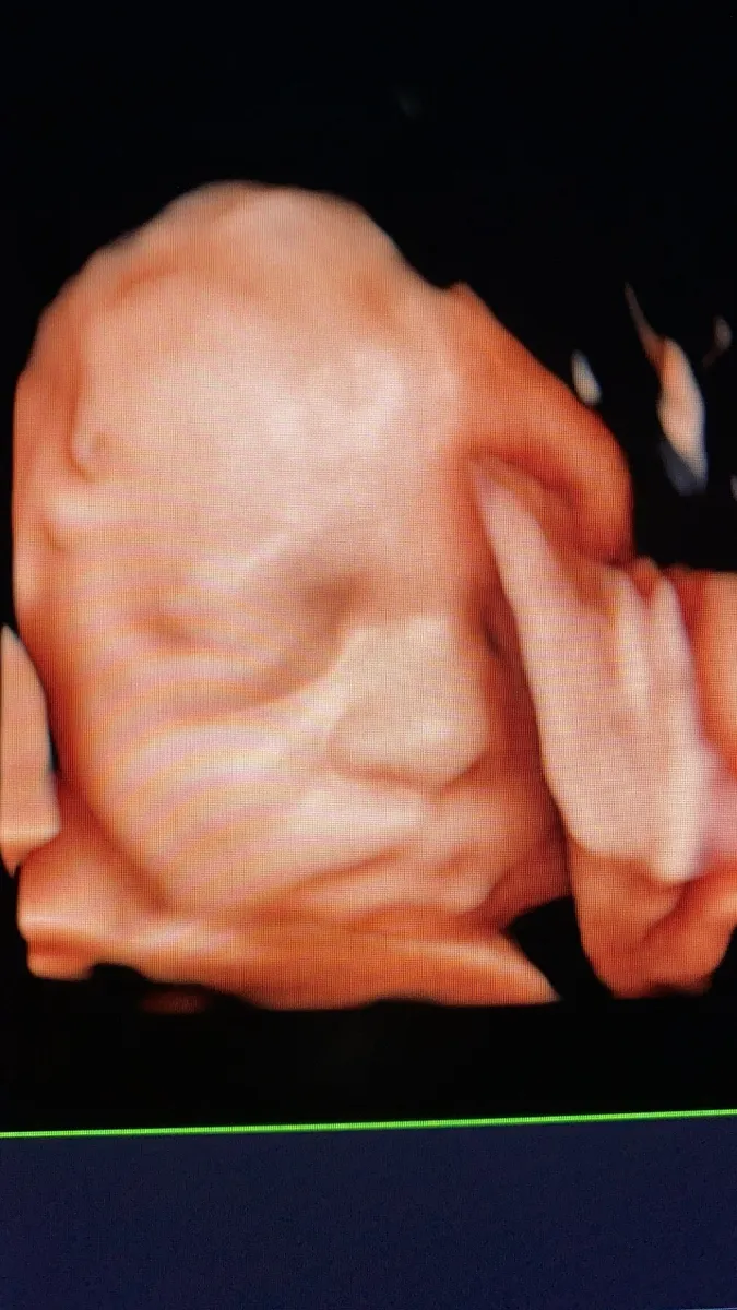 Foto 4 de Dra. Alma Ramírez Gine, por Dra Alma Ramírez Gine - Medicina Fetal - Monterrey