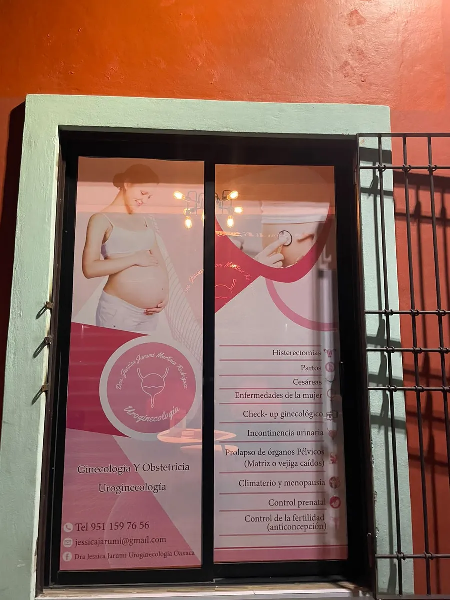 Foto 4 de Dra. Jessica Jarumi Martínez Uroginecóloga Oaxaca, por Dra. Jessica Jarumi Martínez Uroginecóloga Oaxaca
