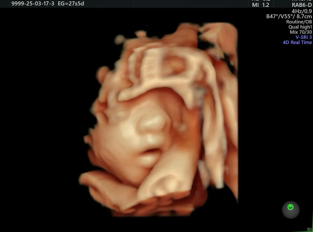 Foto 4 de Dra. Emaan Ali Mohamed Flores, por Dra. Emaan Ali Mohamed Flores, Ginecólogía y obstetricia- medicina materno fetal