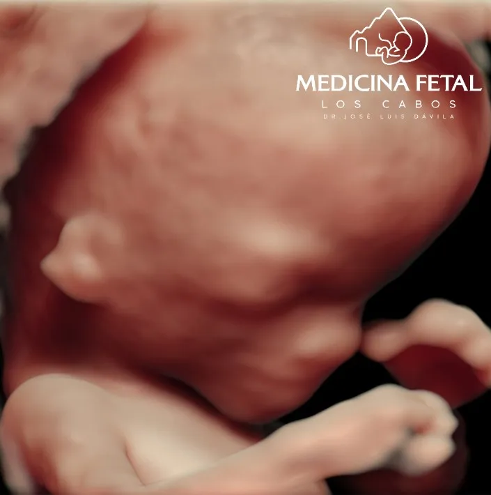 Foto 4 de Dr. Jose Luis Davila, por Dr. Jose Luis Davila - Medicina Fetal Los Cabos