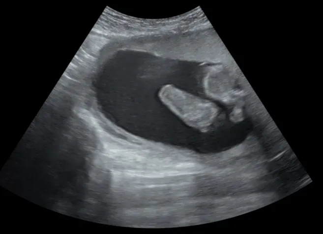 Foto 2 de Dra. Claudia J. Holguin /Medicina, por Dra. Claudia J. Holguin Ginecologia Y Obstetricia/Medicina materno fetal