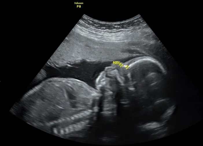 Foto 4 de Dra. Claudia J. Holguin /Medicina, por Dra. Claudia J. Holguin Ginecologia Y Obstetricia/Medicina materno fetal