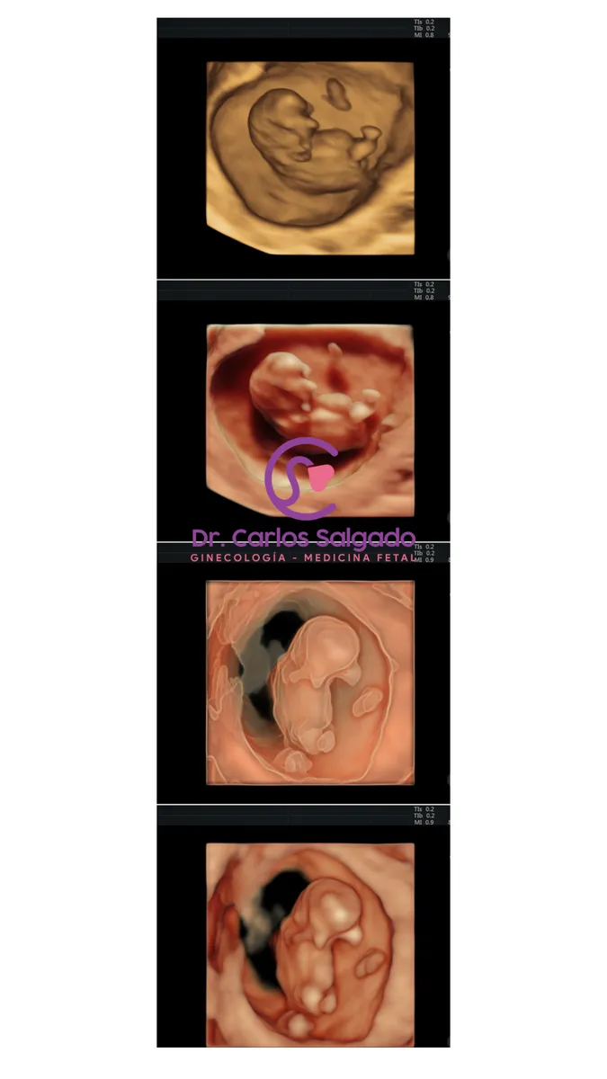 Foto 4 de Dr. Carlos Salgado 4D- Chilpancingo, por Dr Carlos Salgado Ultrasonido 4D- Ginecólogo Chilpancingo