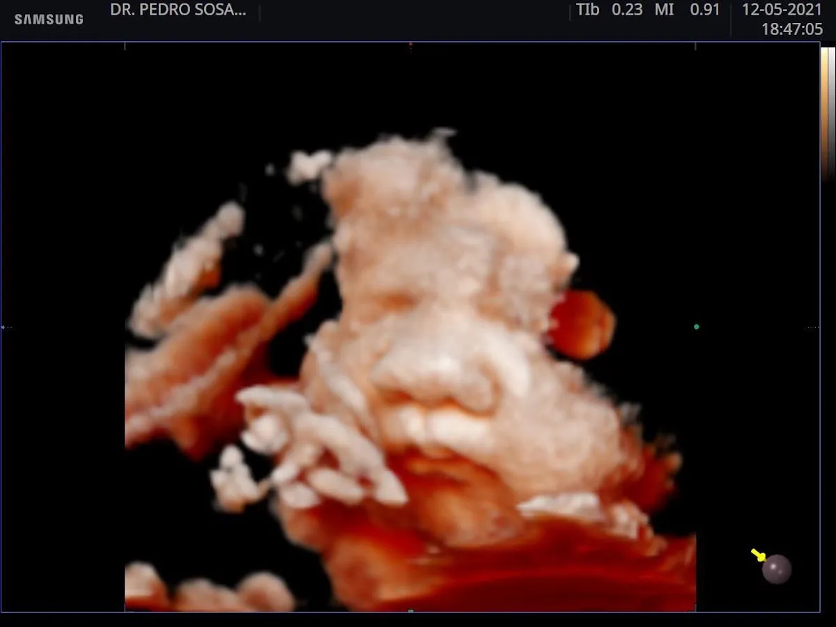 Foto 4 de Dr. Jhon Ricardo Fernández Perinatologia Medicina, por Dr. Jhon Ricardo Fernández Perinatologia Medicina Materno Fetal Obstetricia Ginecologia