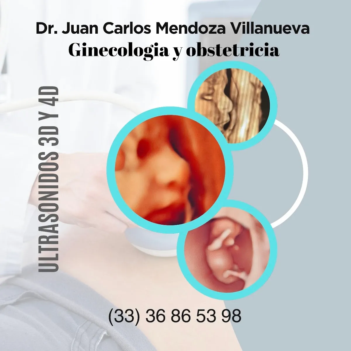 Foto 3 de Dr. Juan Carlos Mendoza Villanueva, por Ginecología y Obstetricia Dr.Juan Carlos Mendoza Villanueva