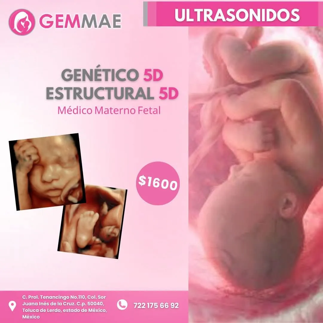 Foto 1 de Gemmae tollocan, por Gemmae tollocan