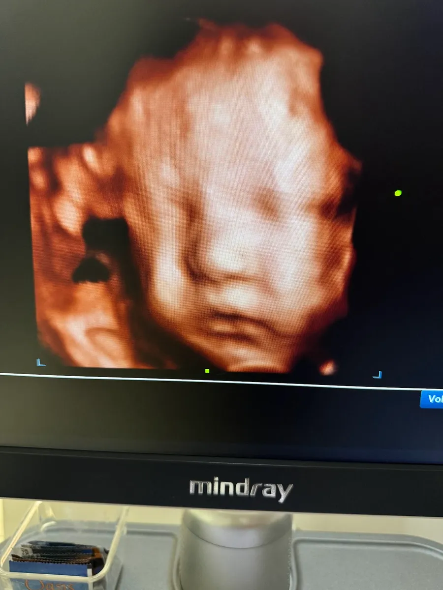 Foto 4 de Dra. Gabriela González, por Dra. Gabriela González / Ginecología y Obstetricia en Puebla