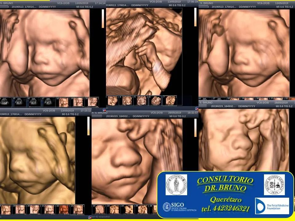 Foto 4 de Dr. Bruno, por Centro Europeo de Ultrasonido y Ginecología - Dr. Bruno