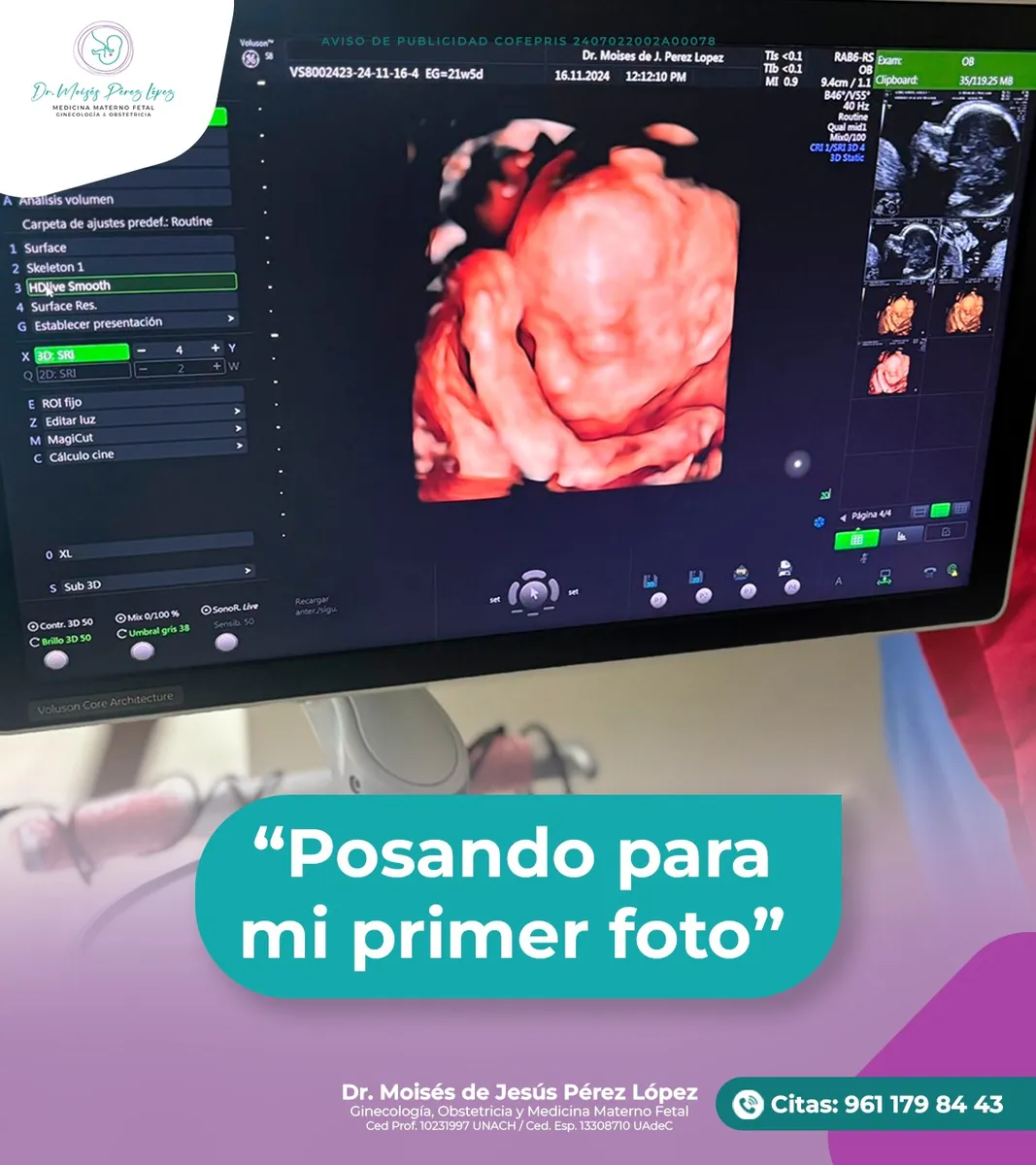 Foto 3 de Dr. y Moises de Jesús perez López Chiapas, por Materno Fetal - Ginecólogo y Obstetra Dr. Moises de Jesús perez López Chiapas