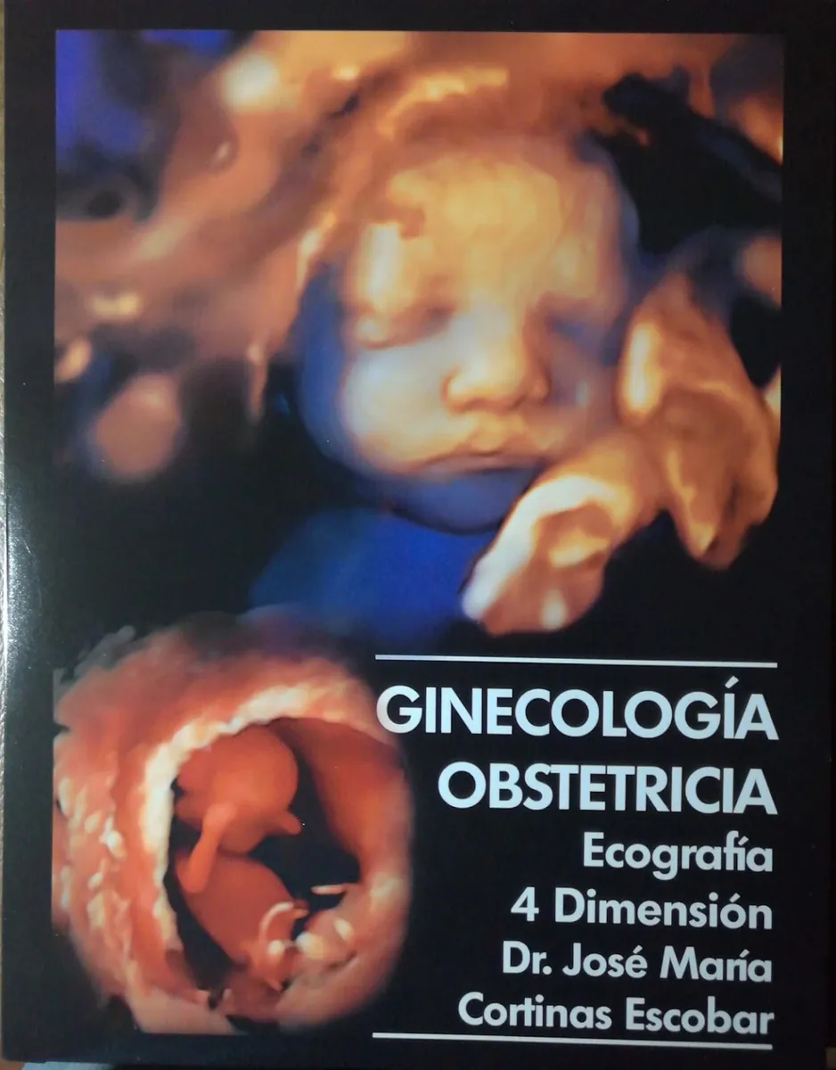 Foto 4 de Ecografía 4d, por ECOGRAFÍA 4D GINECOLOGÍA