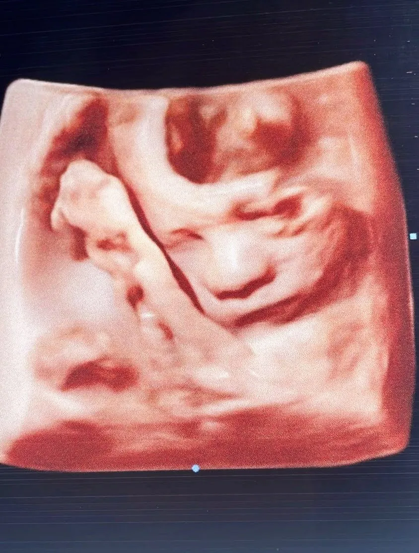 Foto 3 de Dra. parto y cesárea humanizada Rosa L. Cortés, por Ginecología y materno fetal, ultrasonidos avanzados estructural, genético,4D, parto y cesárea humanizada Dra. Rosa L. Cortés