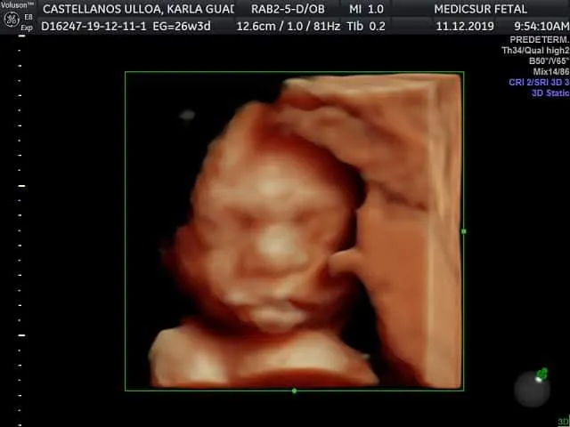 Foto 1 de Medicsur Fetal, por Dr Ruben Aguilera Gonzalez
