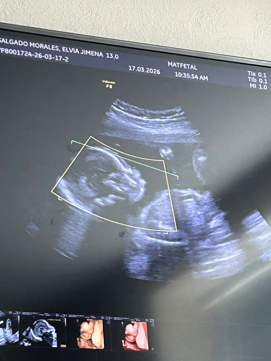 Foto 3 de Matfetal Diagnostico Prenatal, por Elvia Jimena Salgado Morales