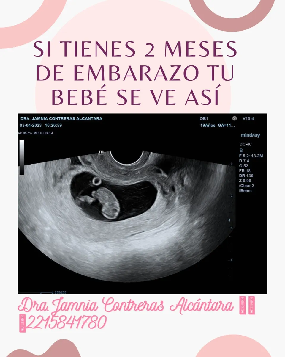 Foto 4 de Dra. Jamnia Contreras, por Dra.Jamnia Contreras Ginecóloga en Puebla