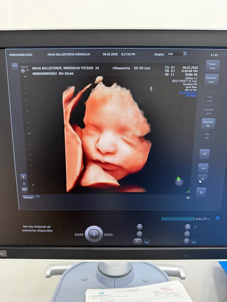 Foto 4 de Dr. David Castellanos, por Fetalux Materno Fetal Oaxaca
